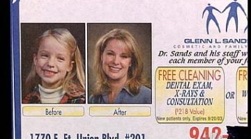 teeth-cleaning-before-and-after