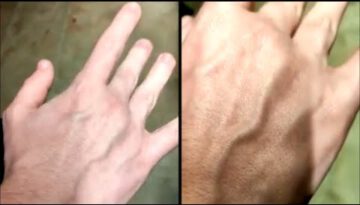 Man That Can Move His Veins