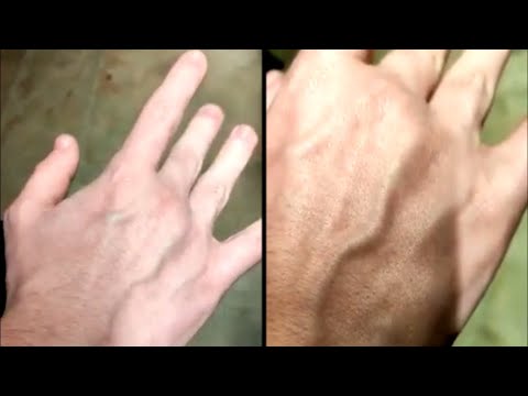 Man That Can Move His Veins