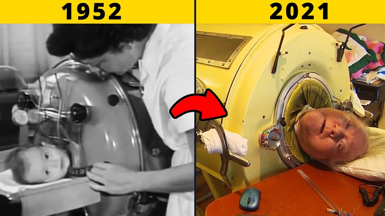 The Man In The Iron Lung