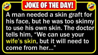 Funny Joke: Face Skin Graft