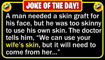 Funny Joke: Face Skin Graft